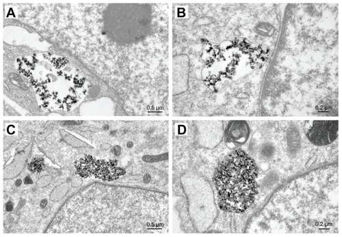 Figure 12 Dissolution of n-HA1 (A) and n-HA2 (C) in MG-63 cells containing lysosomes. After phagocytosis, the particles were scattered and retained their original size and shape within phagosomes. n-HA2 was compacted very tightly and a proportion of the particles began to dissolve. The images in (B and D) represent closer observation.Abbreviation: n-HA, nanohydroxyapatite.