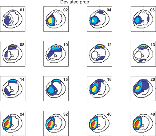 Figure 3. Temperature distribution at a central axial slice through tumor (z = 0 cm) at the end of the feedback iteration number indicated in top right of each panel. The first driving vector was the maximum eigenvector from an initial model with property deviations. The outermost ring is fat, within which is the muscle region. The larger irregular object on the left side of the muscle region is tumor, and the smaller irregular object at the center is bone. The colored regions are: red for ≥43°C, yellow for ≥ 41°C, light blue for ≥40°C and blue for ≥39°C.