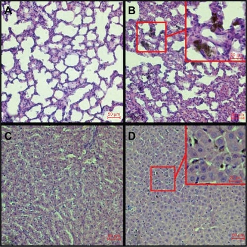 Figure 6 Hematoxylin and eosin-stained histopathological cuts of lung lobe (A control, B injected) and liver (C control, D injected) showing the presence of black SWCNT aggregates after functionalized SWCNT injection at day 1 investigation time point.Abbreviation: SWCNT, single-walled carbon nanotubes.