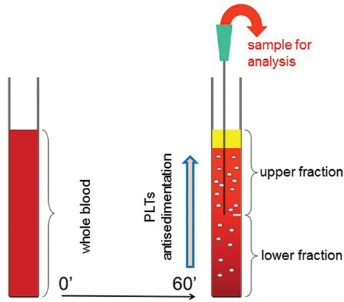 Figure 1. Schematics of the gravity sedimentation technique. Platelet (PLT) antisedimentation rate (PAR) is measured by comparing the platelet count in the upper and lower fractions of the blood column after 1 h of gravity sedimentation at room temperature. PAR (%) is calculated as (Upper − Lower)/(Upper + Lower) × 100.