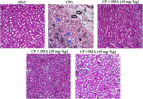 Figure 3. Effect of HEA on cisplatin-induced histopathological changes in kidney tissues (A) Normal control group, (B) Cisplatin group, (C) Cisplatin group + HEA (10 mg kg−1 body mass) group, (D) Cisplatin group + HEA (20 mg kg−1 body mass) group (D) Cisplatin group + HEA (40 mg kg-1 body mass) group.