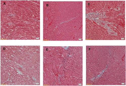 Figure 4 Effects of alpha-mangostin on cardiac fibrosis. (A–F) Masson’s trichrome staining for fibrosis of the cross-sectional tissue slices of left ventricular. Fibrosis is indicated by blue area as opposed to the red myocardium (×200). HF/HG/STZ administration for 11 weeks markedly enhanced fibrotic tissue in myocardium [C]. Treatment with metformin and alpha mangostin [D-F] reduced the fibrotic tissue in myocardium similar to that in control rats [A and B].