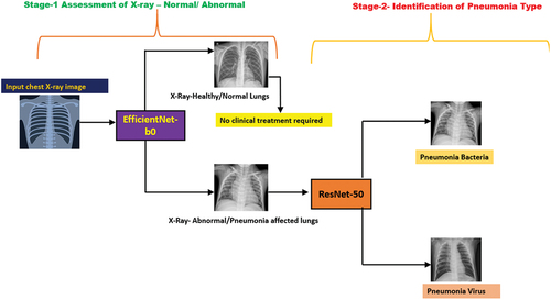 Figure 8. Multiclassification of chest X-ray for pneumonia identification using CNN.