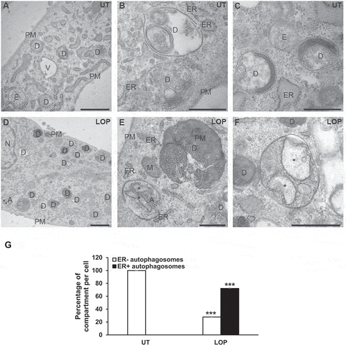 Figure 4. LOP triggers ultrastructural hallmarks of reticulophagy. (A-F) MZ-54 WT cells were left untreated (A-C) or treated with 17.5 µM LOP (D-F) for 48 h before being processed for electron microscopy. Scale bar: 1 µm (A and D) or 500 nm (b, c, e, and f). (G) The average number of ER+ and ER− autophagosomes per cell section was determined as described in Materials and Methods. Significances are calculated versus untreated cells. *** p < 0.001. A, autophagosome; D, degradative compartment; ER, endoplasmic reticulum; M, mitochondria; N, nucleus; PM, plasma membrane; UT, untreated; asterisk, rough-ER fragment