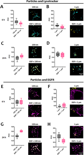 Figure 4 Intracellular localization of SiO2 particles in lung epithelial cells (A549). Colocalization of SiO2 particles (yellow) with lysotracker (cyan) at 6 h (A and B) and 24 h (C and D) in A549 cells. Colocalization of SiO2 particles (yellow) with EGFR (magenta) at 6 h (E and F) and 24 h (G and H). Pearson correlation coefficient (PCC) values are represented in the box and whiskers graphs. Data are presented as mean ± standard error of mean of 10 individual cells. Representative images of a cell region are shown. Scale bar = 5 µm.