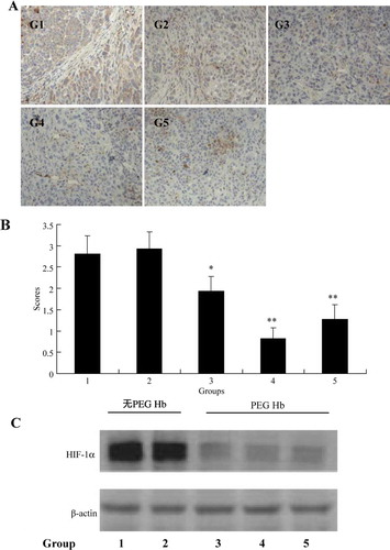 Figure 2.  Tumor hypoxia reflected by (A) images of immunocytochemical staining of Hypoxyprobe-1 in tumor tissue, (B) Pimonidazole binding scores, and (C) expression of HIF-1α. *P < 0.05, **P < 0.05.