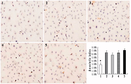 Figure 3. Apoptosis of HK-2 cells examined by TUNEL assay (magnification 200×). (1) normoxia group; (2) hypoxia-like group; (3) transfection reagent group; (4) negative control group; (5) HIF-1α siRNA group. Apoptotic index of normoxia group was significantly lower than the other four groups (*p < .05). Results (means ± SD) are from 6 sets of experiments.