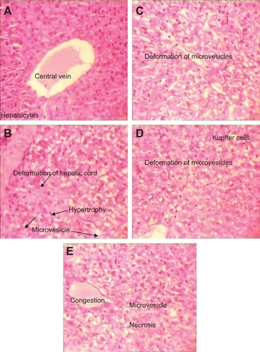 Figure 5 H&E stained liver sections in subchronic toxicity (× 40). A) Normal liver in control group; B) AgNO3 group with hepatic cord deformation; C) Overproduction of Kupffer cells and degeneration of hepatocytes in low-dose nanosilver group; D) Overproduction of Kupffer cells and degeneration of hepatocyte in medium-dose nanosilver group; E) Liver necrosis in nanosilver high-dose group.