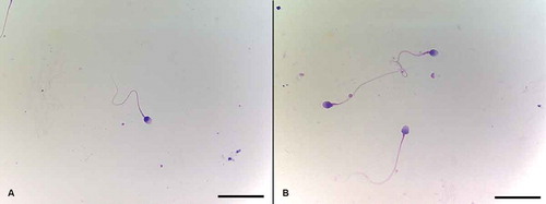 Figure 2. Sperm morphology assessment using Diff Quick Staining. Morphology assessment of both groups was performed under 1,000x magnification according to Kruger’s strict criteria. Normal spermatozoa were scored if the head was smooth, regularly contoured, and generally oval in shape with a well-defined acrosomal region comprising 40–70% of the head area, the midpiece was slender, regular, and about the same length as the sperm head, and the principal piece was uniform along its length, thinner than the midpiece, and approximately 45 µm long (about 10 times the head length). A) Spermatozoon with normal head, acrosome, midpiece, and tail morphology. B) Spermatozoa with slightly abnormal midpiece. Diff Quick staining. Scale bars indicate 25 µm.