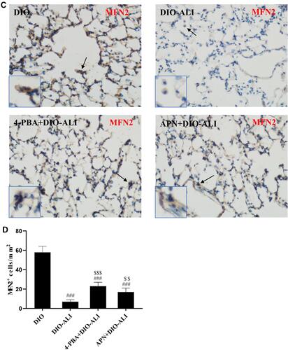 Figure 3 Immunohistochemical staining and quantification analysis of GRP78 (A, B) and MFN2 (C, D) in pulmonary epithelial cells (brown stain). Images were taken at 200× magnification. Data are presented as the mean ± SD. ##, ###p < 0.01, 0.001 vs DIO; $,$$,$$$,p < 0.01, 0.001 vs DIO-ALI.