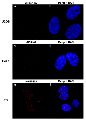 Figure 6. Confocal microscopy imaging of H3S10ac. Confocal images of U2OS (AandB), HeLa (CandD), and ESCs (EandF) stained with α-H3S10A antibody and DAPI to denote the nucleus. Maximum projections are shown. Scale bar in panel f represents 5 µm.