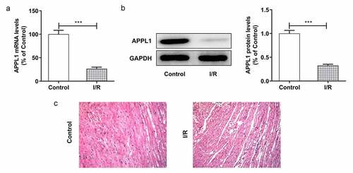 Figure 1. APPL1 expression level is low in myocardial ischemia tissues of mice. (Control: n = 6, H/R: n = 6) (a) The mRNA level of APPL1 in myocardial tissues was measured by Quantitative real-time PCR. (b) The APPL1 protein in myocardial tissues was determined by western blotting. (c) The pathological changes of myocardial tissues were observed by hematoxylin-Eosin (HE) staining. Error bars represent the mean ± SEM from three independent experiments. ***P < 0.001