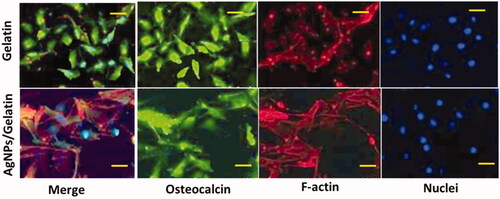 Figure 4. Immunocytochemical (IC) estimation for the prepared samples (AgNPs/Gel bio-composite hydrogel in the absence & presence of NPs).