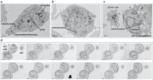 Figure 2. Cell line and primary ALL cell derived LEVs contain intact organelles. (a, b) Transmission electron microscopy (TEM) of cell-depleted, viable SD1 cell culture supernatant, revealed large vesicles. Serum free supernatants from 24-h cultures of SD1 cells were cell depleted by centrifugation (300 × g, twice) and filtered through a double layered, sterile 5 µm pore micro sieve. Low speed centrifugation (2000 × g) of the filtrate provided a population of larger vesicles which were immobilised onto CellTak coated ACLAR film. Samples were processed for TEM by fixation in glutaraldehyde and then incubated with osmium tetroxide and uranyl acetate. Preparations were dehydrated and embedded in resin and sectioned. Images were captured using a Biotwin Philips TECNAI G2 electron microscope. LEVs (4–5 µm) with intact membranes were observed to contain multiple organelles including lysosomes, mitochondria and intermediate filaments but no nucleus. Images were captured at 2900 × magnification. Scale bar is 1 µm. (c) Human LEVs were isolated from patient derived ALL xenografts using human CD19 immunocapture. Engrafted human ALL cells and LEVs were harvested from the spleens of NSG mice by immuno-capture using a magnetic bead conjugated anti-human CD19 antibody. Eluates were seeded onto CellTak coated ACLAR film and processed as in (a). The figure represents one of serial sections taken through the LEV and neighbouring cell and shows the LEV to have an intact membrane, organelles and distinct cytoplasmic protrusions, but no nucleus. (d) Representative serial sections through CD19 captured ALL cells and LEVs confirmed the size and absence of a nucleus. Serial sections showed the LEV had an intact membrane, cytoplasmic protrusions, mitochondria and no nucleus and is ~4.2 µm in size. Sections shown represent ~1 µm: Initial section shown is 200 nm thick followed by 11 sections at 80 nm.