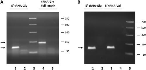 Figure 1. Analysis of RT-qPCR products of circulating tRFs obtained by the miR-Q approach. (A) Products for tRNA-Gly-GCC, CCC 5′ end and full-length tRNA-Gly-GCC, CCC analysed by agarose gel electrophoresis. Lane 1: RT-qPCR product generated with primers for 5′ end of tRNA-Gly. Lane 2: minus cDNA control with primers for 5′ end. Lane 3: PCR markers; size in base pairs indicated on the left. Lane 4: RT-qPCR product generated with primers for full-length tRNA-Gly. Lane 5: minus cDNA control with primers specific for full-length tRNA. (B) Products for the 5′ ends of tRNA-Glu-CTC and tRNA-Val-CAC, AAC analysed by agarose gel electrophoresis. Like in a products obtained in the presence and absence of cDNA were analysed. The expected sizes for the miR-Q products (indicated by arrows) are 89 base pairs for tRNA-Gly and 94 base pairs for tRNA-Glu and tRNA-Val.