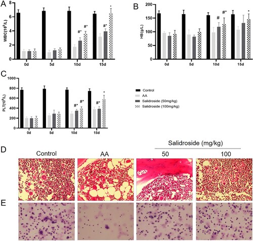 Figure 3. Blood counts, bone marrow smear, and bone marrow pathological changes after salidroside treatment in the AA mice model. (A) White blood cell counts at different time points after salidroside administration. (B) Hemoglobin at different time points after salidroside administration. (C) Platelet count at different time points after salidroside administration. #, P < 0.05 compared with the control group; *, P < 0.05 compared with the AA group. (D) Blood cell smears in each group after the 15 days of administration (150×). (E) Bone marrow pathology in each group after the 15 days of administration (400×).