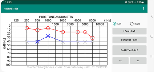 Figure 3 A screenshot from the Hearing Test app during the assessment of hearing threshold using the stimulus intensity self-adjustment method.