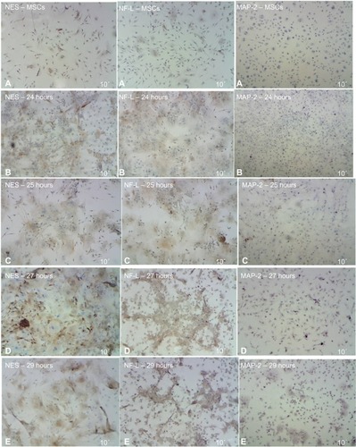 Figure 7 ICC detection results of MSCs after induced differentiation by BME, which showed the increase of NES and NF-L protein through the different exposure times, compared with no increase of MAP-2 protein as revealed under light microscope.