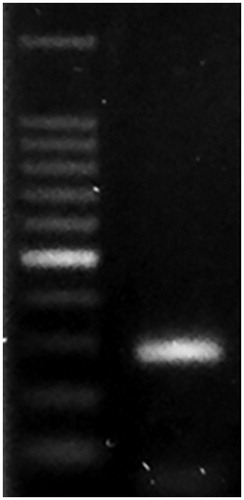 Figure 2. PCR amplification of genomic DNA using ITS-1 primers of E. tenella. M: 100 bp DNA ladder.