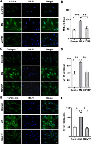 Figure 6. M2 supernatant promoted HTF activation and ECM synthesis. HTFs were treated with fresh culture medium (control), M2-conditioned medium only and verteporfin (VTP) (1.5 μmol/L, 3 h) followed by M2-conditioned medium treatment (M2/VTP) for 24 h. The expression levels of α-SMA, collagen I and fibronectin were evaluated by immunofluorescence staining. (A) Representative immunofluorescence images of HTFs stained with an anti-α-SMA antibody. Scale bars: 10 μm. (B) Quantitative analysis of the MFI of α-SMA.  **P < 0.01, ***P < 0.001; n = 3. (C) Representative immunofluorescence images of HTFs stained with an anti-collagen I antibody. Scale bars: 10 μm. (D) Quantitative analysis of the MFI of collagen I. **P < 0.01; n = 3. (E) Representative immunofluorescence images of HTFs stained with an anti-fibronectin antibody. (F) Quantitative analysis of the MFI of fibronectin. *P < 0.05; n = 3. All experiments were repeated three times independently.