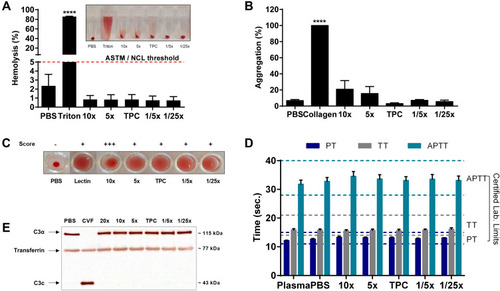 Figure 4 Hemocompatibility of DEAE12-CH-PEG-FA2/siRNA nanoparticles. (A) Hemolysis percentage induced by nanoparticles and visual inspection of tubes after the centrifugation step (inset). Human blood was incubated with samples for 3 h at 37°C. DPBS and triton represent the negative and positive controls, respectively. Pink dash line shows the 5% threshold of ASTM from which a sample is considered to have hemolytic properties. Data are expressed as the mean ± SEM of three independent experiments and were analyzed by One-way ANOVA (post hoc Dunnett’s test). (B) Nanoparticle platelet aggregation profiles after platelet-rich plasma was incubated with samples for a 6 min run at 37°C. PBS and collagen represent the negative and positive controls, respectively. Data are expressed as the mean ± SEM of three independent experiments and were analyzed by One-way ANOVA (post hoc Dunnett’s test). (C) Hemagglutination activity produced by nanoparticles in an erythrocyte suspension after 1 h of incubation at 37°C. DPBS and lectin represent the negative and positive controls, respectively. Pictures represent one of three independent experiments with similar results. The agglutination analysis was performed as described in the methods. (D) Effect of particles on plasma coagulation times: prothrombin time (PT), thrombin time (TT) and activated partial thromboplastin time (APTT). Measures were taken after a 30 min incubation of human plasma with samples at 37°C. The normal coagulation time limits are indicated with a colored dash line (PT 11 ≤ 15s (dark blue), TT 14 ≤ 21s (gray) and APTT 28 ≤ 40s (light green)). Non-treated plasma and DPBS were used as internal controls for the test. Data are expressed as the mean ± SEM of four independent experiments and were analyzed by Two-way ANOVA (post hoc Dunnett’s test). (E) Complement activation assay showing the expression levels of a native C3α chain (~115 kDa) and its cleavage product C3c (~43 kDa), after human plasma exposure to nanoparticles for 30 min at 37°C. DPBS and CVF represent the negative and positive controls, respectively. Transferrin (~77 kDa) was used as a serum loading control. Blots represent one of three independent experiments with similar results. For all experiments, blood samples were collected from at least three healthy human donors. ****p<0.0001 are significantly different from the negative control. See Table 1 for DEAE12-CH-PEG-FA2 and siRNA concentrations.