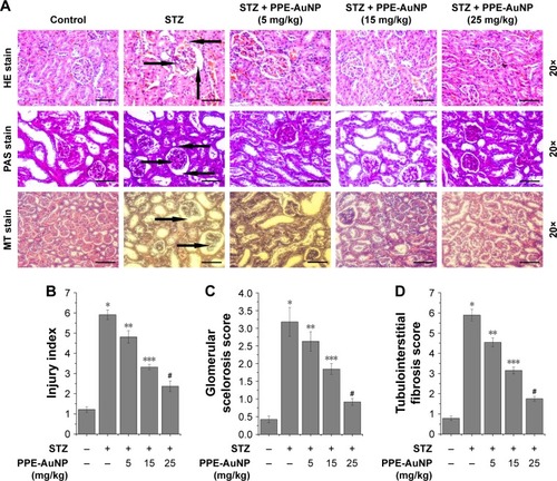 Figure 6 Renal tissue morphological assessment by histopathology using (A) hematoxylin and eosin staining, periodic acid–Schiff staining, Masson’s trichrome staining (magnification: 20×); the arrows highlight morphological change. Representative bar graph showing quantitative analysis of (B) nephritic injury index, (C) glomerular sclerosis score, and (D) tubulointerstitial fibrosis. Values are represented as mean ± SEM (n=6). P<0.05 was considered as significant. Statistical comparison: *Control vs STZ; **STZ vs STZ + PPE-AuNP (5 mg/kg); ***STZ vs STZ + PPE-AuNP (15 mg/kg); #STZ vs STZ + PPE-AuNP (25 mg/kg).Abbreviations: AuNP, gold nanoparticle; H&E, hematoxylin and eosin; MT, Masson’s trichrome; NS, nonsignificant; PAS, periodic acid-Schiff; PPE, pomegranate peel extract; SEM, standard error of mean; STZ, streptozotocin.