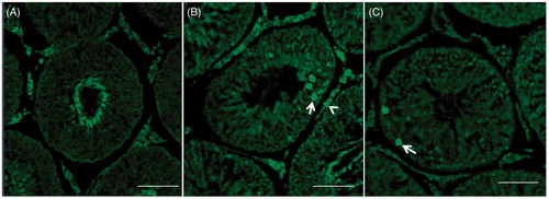 Figure 3. Control and stressed rat testicular sections. (A) Control testis showed non-significant TUNEL-positive cells. (B) Seminiferous tubules TUNEL-positive cells increase (arrows) observed only at 1 hour after acute stress induction. (C) Chronic stressed (50 days) seminiferous tubules displayed scattered TUNEL-positive cells. Some apoptotic Leydig cells were also observed (arrowhead). Bar = 50 µm; magnification: 400×.