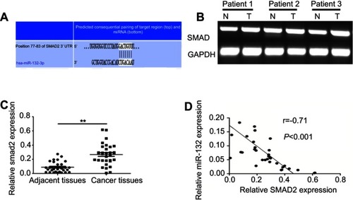Figure 5 Correlation between SMAD2 and miR-132 expression in bladder cancer. (A) The prediction of combine state between miR-132-3p and the 3ʹUTR of Smad2 on the website of www.targetscan.org. (B) Semi-quantitative results showed the expression of SMAD2 was increased in the tumor tissue compared to in the matched normal tissues in bladder cancer patients. (C) The mRNA expression of SMAD2 in bladder cancer tissues was significantly increased in bladder cancer tissues compared to in normal tissues. (D) Correlation between SMAD2 and miR-132 expression was negative by Pearson’s correlation analysis (r=−0.71, p<0.001). Note: **p<0.01. Abbreviations: N: normal control; T: bladder cancer patient.