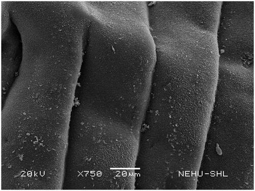 Figure 3. Portion of the body (strobila) of untreated T. tetragona. Body segments (proglottids) indicate smooth tegument.