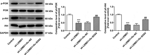 Figure 7. SOX4-induced LEMD1 activates the PI3K/AKT signaling in colon cancer cells. Western blot analyzed the protein levels of p-PI3K/PI3K and p-AKT/AKT in HCT116 cells. ***P < 0.001 vs. control; ###P < 0.001 vs. sh-LEMD1+ Ov-NC.