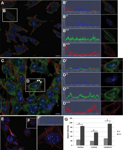 Figure 8. RNA transfer from UB-derived exosomes to pMM cells. (a) RNA transfer from exosomes to pMM cells at 2 h after co-culture of labelled exosomes and cells. (b) The localization of RNA is very robust in the cytoplasm, but also occurs in the nucleus and nucleoli. (Bʹ–Bʺ) Example of signal intensity profiles analysed in G. (c) Intensity of RNA presence in cells after 24 h. (d) The RNA signal is much more intense at 24 h and can be found in the cytoplasm, nucleus and nucleoli. Arrowheads point to cytoplasmic vacuoles with high RNA signal intensity. (Dʹ–Dʺ) Example of signal intensity profiles analysed in G. (e) Control sample showed lack of RNA label in cells in the absence of exosomes. (fʹ) Example of signal intensity profiles of control sample. (g) Comparison of RNA signal intensity between 2 h and 24 h samples showing significant difference (*p ≤ 0.0001) in nucleus, nucleoli and cytoplasm where high accumulation was observed after 24 h. Green – RNA (from exosomes), red – phalloidin (filamentous actin), blue – DAPI (nucleus); scale bar: 10 µm.
