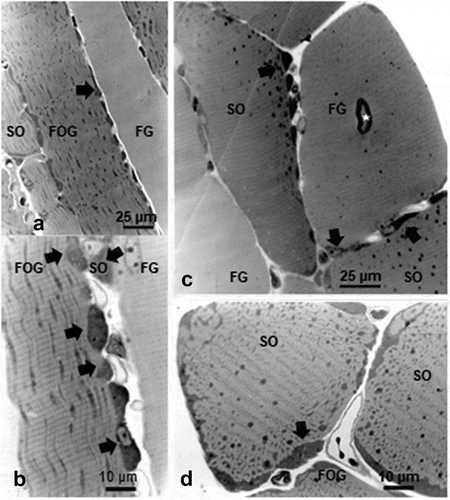 Figure 1. a-d: Pane of 1-µm thick longitudinal (a – c) and oblique cross-sections (b – d) of one 45 weeks old female obese Zucker tibialis anterior muscle, stained by toluidine blue. A cursory view reveals basophilic perikaryal and intermyofibrillar components in all the oxidative fibers, giving them a sort of ‘ragged’ aspect (black arrows). In overall, qualitatively, the muscle fiber diameters appeared as FG > FOG > SO types, whose diameter was verified quantitatively in (Figure 2(a-c)). b center displays a spot-fold artifact, not a central nucleus