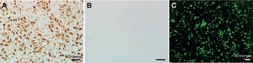 Figure 2 The expression of aldose reductase in COS-7 cells transfected with (A) the plasmid of pHAR and (B) empty vector by immunohistochemistry. (C) The expression of EGFP in COS-7 cells transfected with the plasmid of pHAG.Note: Scale bar: 50 μm.Abbreviation: EGFP, the green fluorescent protein gene.