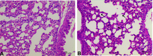 Figure 6 The pathological changes of the lung tissue of MRSA-infected mice. (A): control group, (B): model group.