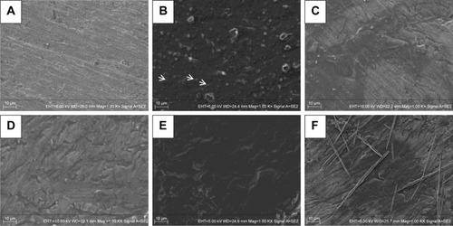 Figure 3 SEM images of different surfaces.Notes: SEM images of (A) Ti; (B) Ti-PTL, Ti after PTL priming; (C) Ti-PTL-HA, Ti-PTL nanofilm after single HA coating; (D) Ti-PTL-HA-CS, Ti-PTL nanofilm after HA-CS coating; (E) HA/CS, Ti-PTL nanofilm coated with multilayer of HA-CS; (F) HA/CS-ICA-L, Ti-PTL nanofilm coated with multilayer of HA-CS with ICA immobilization. Arrow indicates nanosphere structure, asterisk indicates micro-holes.Abbreviations: CS, chitosan; HA, hyaluronic acid; ICA, icariin; ICA-L, ICA-low dose; PTL, phase-transited lysozyme; SEM, scanning electron microscopy; Ti, titanium.