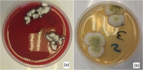 Figure 4 Culture positive for fusarium Solani on blood agar (a) and SDA (b).