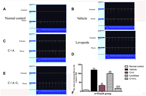 Figure 2 C16+Ang-1 and C+A+L alleviated muscle synchronous contraction. Wave amplitude (uV) was measured. (A) control; (B) MPTP; (C) MPTP and C16+Ang-1; (D) MPTP injection and levodopa; (E) MPTP and C+A+L; (F) synchronous contraction amplitude of extensor/flexor in each group. a, P < 0.05 versus control; b, P < 0.05 versus vehicle group; c, P < 0.05 versus C16+Ang-1 treated group; d, P < 0.05 versus levodopa-treated group.