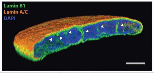 Figure 1. Super resolution light microscopy on normal human dermal fibroblasts, labeled with anti-lamin B1 antibody (green), anti-lamin A/C antibody (orange) and DAPI (blue). White arrowheads point to intranuclear NR tubules. Scale bar, 2 µm.