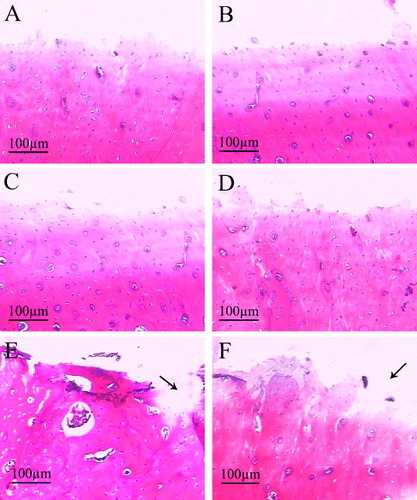 Figure 9. H&E staining of remaining bone defects for the implantation of 4 weeks (A), (C), (E) and 8 weeks (B), (D), (F) after the implants were pulled out (n = 3). A, B: pure Ti; C, D: CaP/ Ti; E, F: CaP/gel/Ti. Some bone tissues were torn out by pulling out the implants and the big voids left (the black arrow).