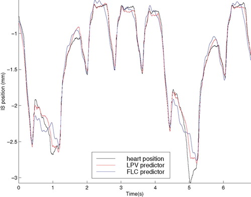 Figure 15. Predictor output for 1χ anticipation. [Color version available online.]