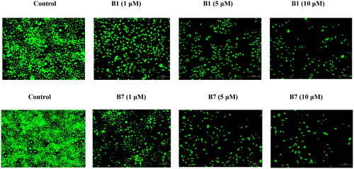 Figure 4. The cell morphology of B1 and B7 was observed using an orthotropic fluorescence microscope.