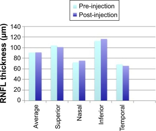 Figure 1 Pre- and post-injection quadrant and average RNFL thickness.
