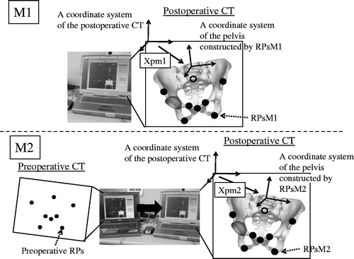 Figure 2. Manual methods for constructing a bony coordinate system on postoperative CT images. These examples are for a pelvic coordinate system. For the first manual method (M1), postoperative RPs, or RPsM1, were chosen at the prescribed position without a specific tool in one planning module. The pelvic coordinate system constructed using RPsM1 was defined by an affine matrix (Xpm1) in the coordinate system of postoperative CT images. For the second manual method (M2), postoperative RPs (RPsM2) were chosen at a position with as little deviation as possible from preoperative RPs by checking preoperative RPs on another monitor. The pelvic coordinate system constructed using RPsM2 was defined by an affine matrix (Xpm2) in the coordinate system of postoperative CT images.