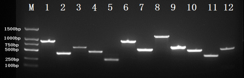 Figure 2 Agarose gel electrophoresis of some virulence-associated genes, antimicrobial resistance genes and capsule serotype genes.