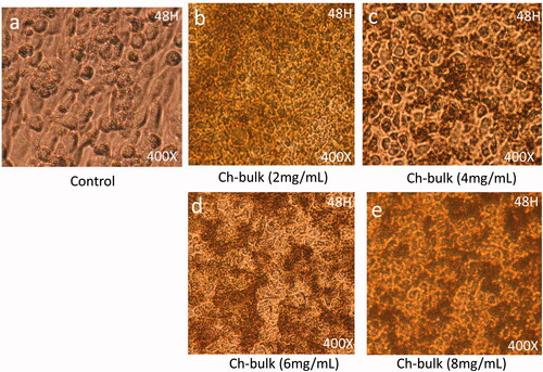 Figure 6. Cancer Cell morphology after treatment of Ch-bulk: The HCT-116 cells analyzed 48 h post-treatments (a) is control; (b) is treated with dose 2 mg/mL, (c) is treated with 4 mg/mL, whereas (d) and (e) are treated with 6 mg/mL and 8 mg/mL. The dose of 4 mg/mL showed strong nuclear condensation and augmentation and showed beginning of cell membrane disruption. 400× magnifications.