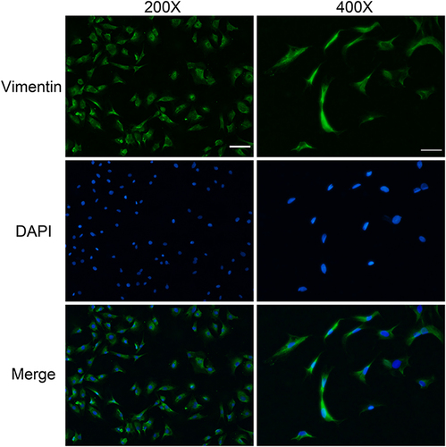 Figure 2 Vimentin immunofluorescence staining. Cells were isolated from dermal tissue. Vimentin (+) staining in the cytoplasm showed green fluorescence, and nuclei were blue. (200 x scale bar = 50 µm, 400 x scale bar = 25 µm).