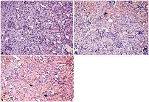 Figure 4. Immunohistochemical staining of caspase-8 in rat kidney (200×). (A) HRs showed no immunopositivity, (B) DRs showed moderate immunopositivity in tubular cells (arrowhead) and glomeruli (arrow), and (C) DRs + CN showed severe immunopositivity for caspase-8 in tubular cells (arrowhead) and glomeruli (arrow).