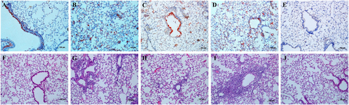 Fig. 5 Replication and pathological changes in the lungs of mice inoculated with recombinant viruses.Eight- to ten-week-old female C57BL/6 mice (n = 3/time-point) were inoculated intranasally with 103 TCID50 of the rgHuN-PB2701D viruses (a, f) and rgHuN-PB2701N viruses (c, h) or 105 TCID50 of the rgHuN-PB2701D viruses (b, g) and rgHuN-PB2701N viruses (d, i). Mice receiving PBS (e, j) were used as controls. Mice were killed at 4 dpi, and the lung lobes were used for NP antigen staining (upper panel) and hematoxylin and eosin (H&E) staining (lower panel)