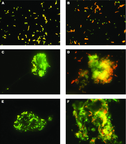 FIG. 1 Visualization of airborne bacteria collected and stained on RTV silicone (“Grimm Silicone 1228”). A: Cells of Bacillus subtilis and Staphylococcus xylosus aerosolized in a laboratory test system and stained with SYBR® Green or B: SYBR® Safe. C, E: Airborne particles stained with SYBR® Green collected in an alternative keeping system for laying hens. D: Aggregate of coccid bacteria collected in a stable for mixed farm animals stained with SYBR® Safe. F: Airborne particle stained with SYBR® Safe collected in a pig confinement system. (Color figure available online.)
