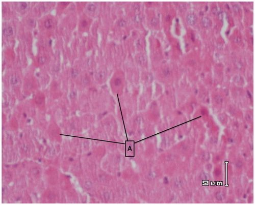 Figure 7. Paraffin sections stained by haematoxylin and eosin (H&E) for histopathological examination of liver tissues of rats treated with APAP (500 mg/kg) and RA (50 mg/kg). There are some regions of recovery and only apoptotic cells can be seen that are depicted with A letter (apoptosis).